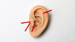 plastic model of ear with acupuncture needles in it - benefits of auricular acupuncture