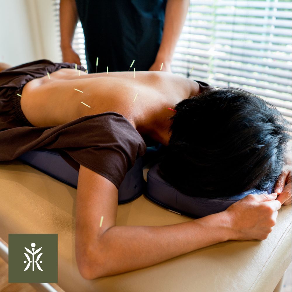 a patient receiving acupuncture treatments lying face down on a couch