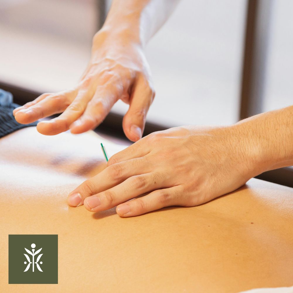 Acupuncture treatments being applied to a back